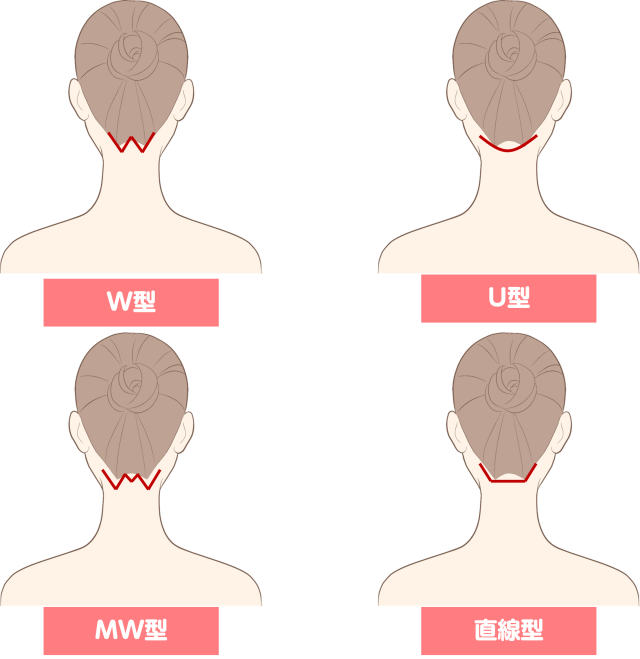 うなじ脱毛の図解