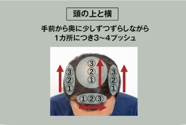 モウダス薬用発毛促進剤塗布前